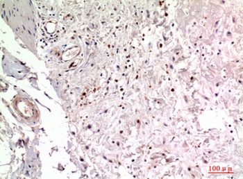 Integrin α2 rabbit pAb Antibody