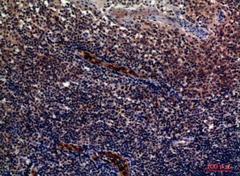 P-Selectin rabbit pAb Antibody