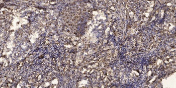 LIR-1 rabbit pAb Antibody