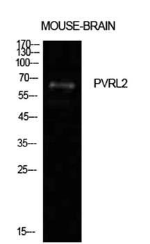 Nectin 2 rabbit pAb Antibody
