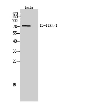 IL-12Rβ1 rabbit pAb Antibody