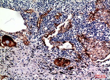 Mucin 1 rabbit pAb Antibody