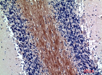 SIRP-α1/β1 rabbit pAb Antibody