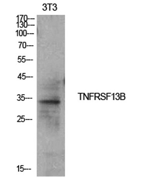 CD267 rabbit pAb Antibody