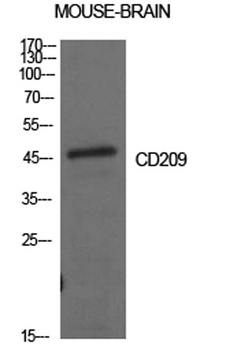 CD209 rabbit pAb Antibody