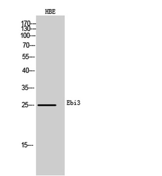 Ebi3 rabbit pAb Antibody