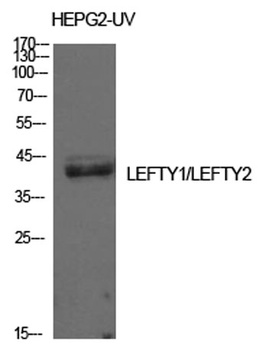 Lefty rabbit pAb Antibody