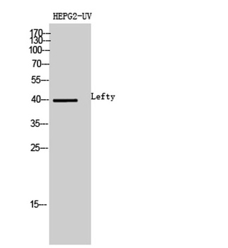 Lefty rabbit pAb Antibody