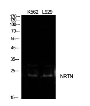 NTN rabbit pAb Antibody