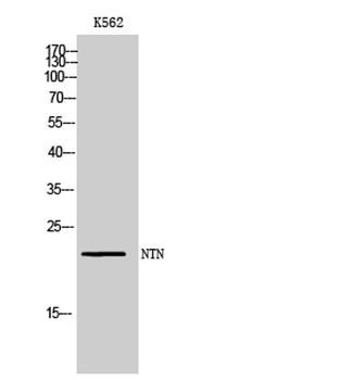 NTN rabbit pAb Antibody
