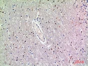 GDF-7 rabbit pAb Antibody
