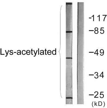 Acetyl Lys proteins rabbit pAb Antibody