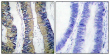 4E-BP1 (phospho Thr69) rabbit pAb Antibody