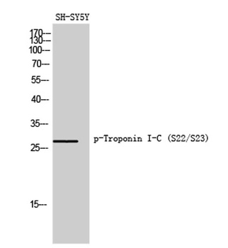 Troponin I-C (phospho Ser22/S23) rabbit pAb Antibody
