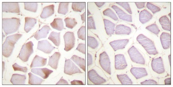 Troponin I-C (phospho Ser22/S23) rabbit pAb Antibody