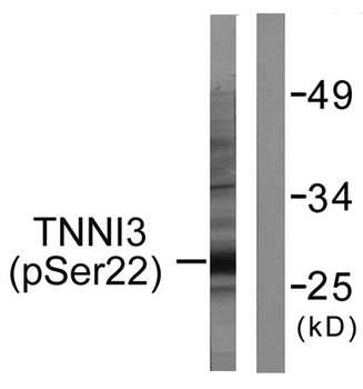 Troponin I-C (phospho Ser22/S23) rabbit pAb Antibody