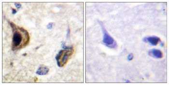 KIR5.1 (phospho Ser416) rabbit pAb Antibody