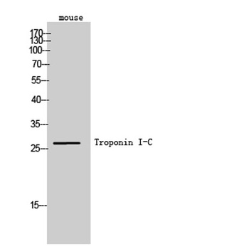 Troponin I-C rabbit pAb Antibody