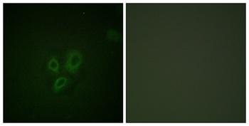 Troponin I-C rabbit pAb Antibody