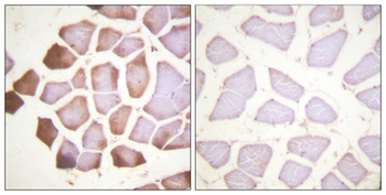 Troponin I-C rabbit pAb Antibody