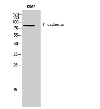 P-cadherin rabbit pAb Antibody