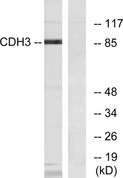P-cadherin rabbit pAb Antibody