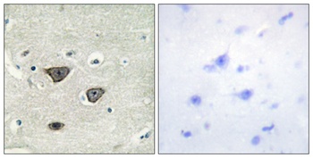 Cadherin-8 rabbit pAb Antibody