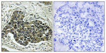 KIF20A rabbit pAb Antibody