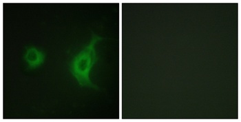 KIF20A rabbit pAb Antibody