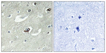 KIF20A rabbit pAb Antibody