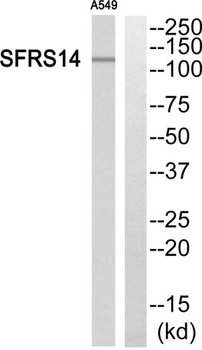 SFRS14 rabbit pAb Antibody