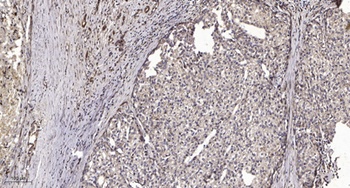 SFRS14 rabbit pAb Antibody