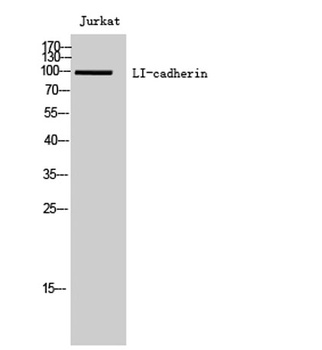 LI-cadherin rabbit pAb Antibody