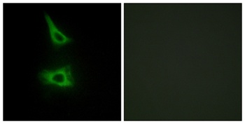 LI-cadherin rabbit pAb Antibody