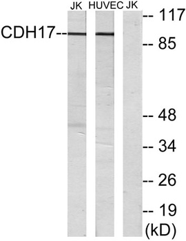 LI-cadherin rabbit pAb Antibody