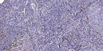 LI-cadherin rabbit pAb Antibody