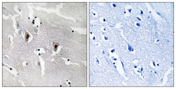 DEF-3 rabbit pAb Antibody