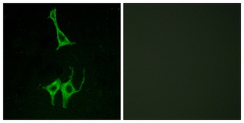 NMUR1 rabbit pAb Antibody