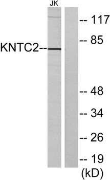Hec1 rabbit pAb Antibody