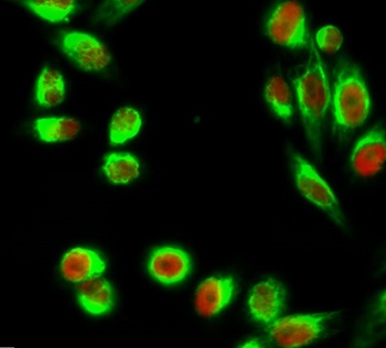 C/EBP β rabbit pAb Antibody