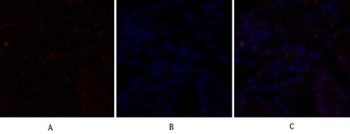C/EBP β rabbit pAb Antibody