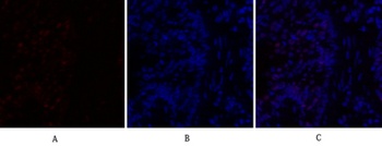 C/EBP β rabbit pAb Antibody