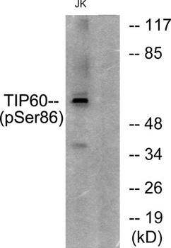 TIP60 (phospho Ser86) rabbit pAb Antibody