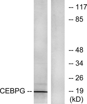 C/EBP γ rabbit pAb Antibody