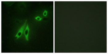 AKAP 110 rabbit pAb Antibody