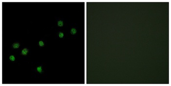 CENP-A rabbit pAb Antibody
