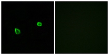 IREβ rabbit pAb Antibody