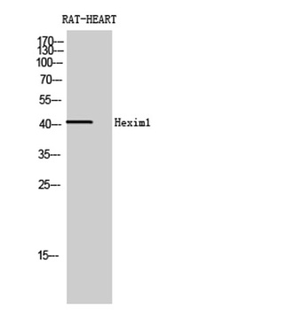 Hexim1 rabbit pAb Antibody