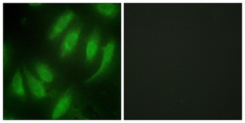 Hexim1 rabbit pAb Antibody