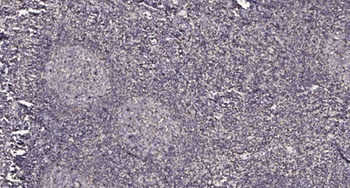 POLR3C rabbit pAb Antibody